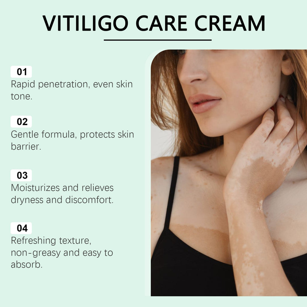 Vitiligo Herbal Cream