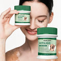 Vitiligo Herbal Cream