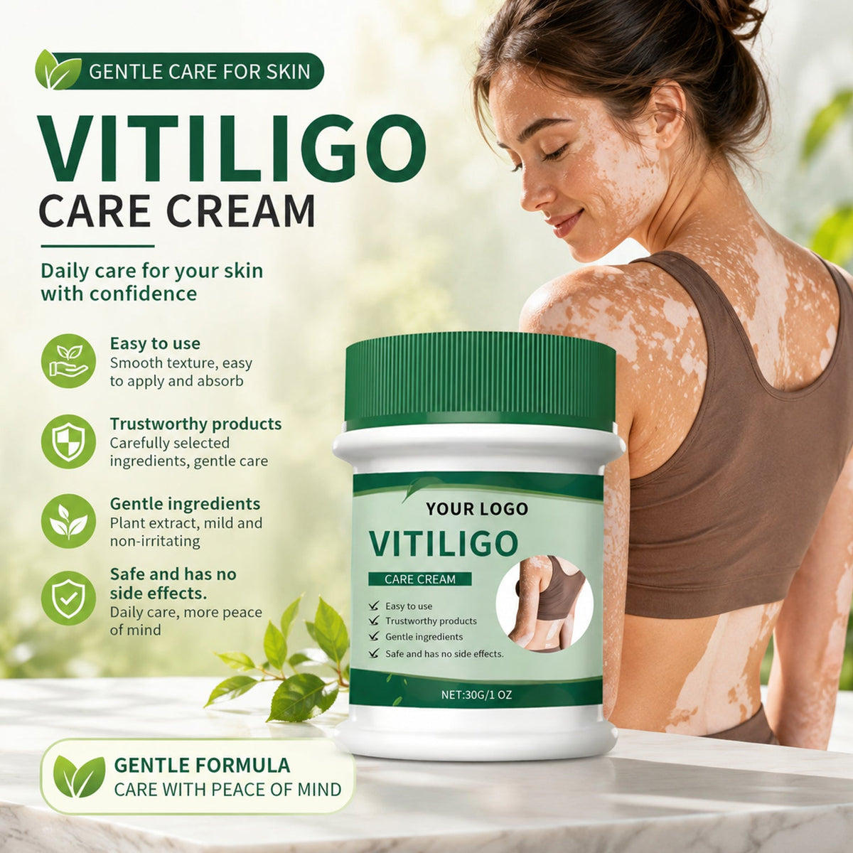 Vitiligo Herbal Cream